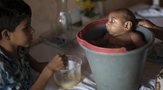 Dấu hiệu nhiễm virus Zika gây teo não bẩm sinh benh nao nho do virus zika