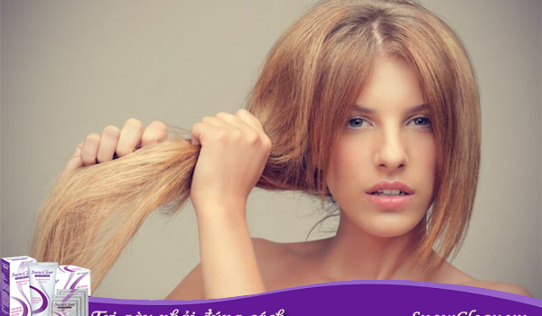 Những nguyên nhân không ngờ khiến da đầu nhiều gàu dau goi tri gau