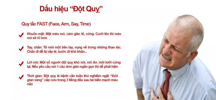 4 quy tắc sơ cứu người đột quỵ não kịp thời nguyen tac so cuu dot quy nao